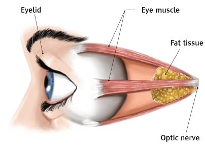 Healthy eye before Thyroid Eye Disease Diagnosis